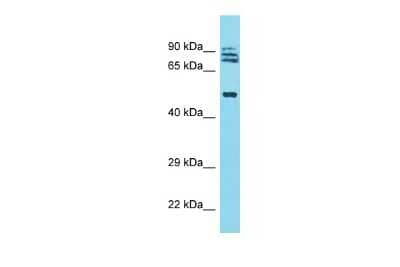 Western Blot: TRIM64A Antibody [NBP2-83713]