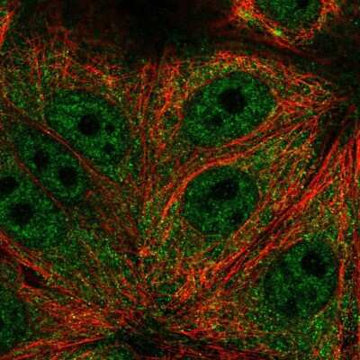 Immunocytochemistry/ Immunofluorescence: TRIM65 Antibody [NBP2-57590]