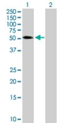 Western Blot: TRIM65 Antibody [H00201292-B01P]