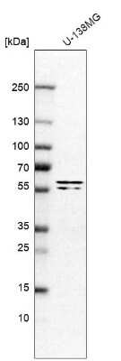 Western Blot: TRIM65 Antibody [NBP1-86017]