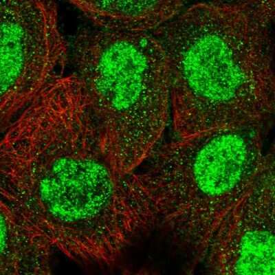 Immunocytochemistry/ Immunofluorescence: TRIM66 Antibody [NBP1-90742]