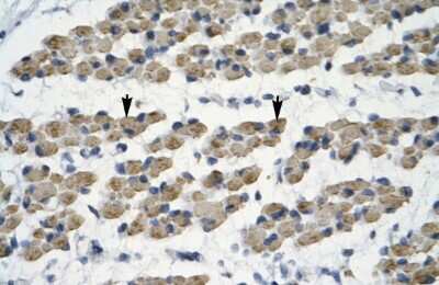 Immunohistochemistry: TRIM68 Antibody [NBP2-88478]