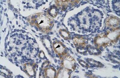 Immunohistochemistry: TRIM68 Antibody [NBP2-88479]
