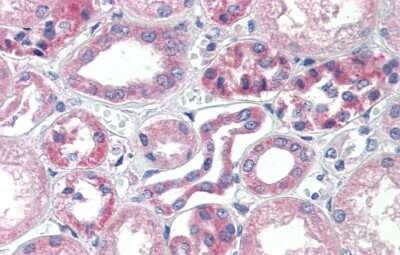Immunohistochemistry: TRIM68 Antibody [NBP2-88480]