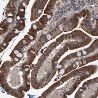 Immunohistochemistry-Paraffin: TRIM68 Antibody [NBP1-83863]