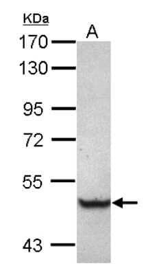 Western Blot: TRIM68 Antibody [NBP2-20724]