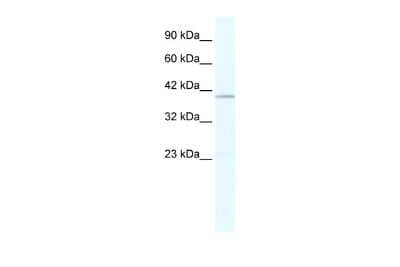 Western Blot: TRIM68 Antibody [NBP2-88478]