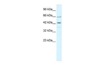 Western Blot: TRIM68 Antibody [NBP2-88479]