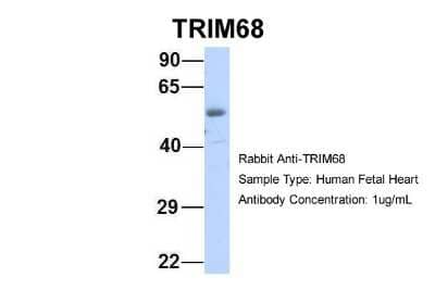 Western Blot: TRIM68 Antibody [NBP2-88480]