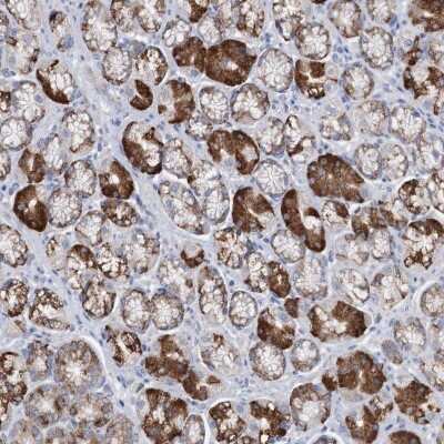 Immunohistochemistry-Paraffin: LIN-41/TRIM71 Antibody [NBP2-34043]