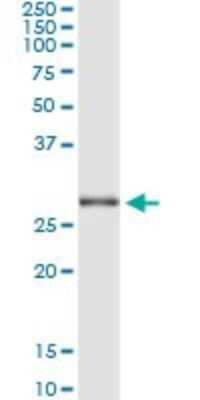 Immunoprecipitation: TRIM72 Antibody (2B8) [H00493829-M04]