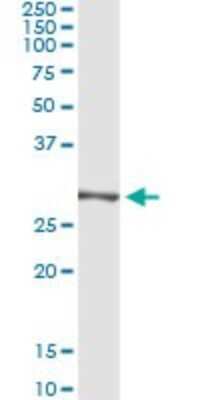 Immunoprecipitation: TRIM72 Antibody (2G1) [H00493829-M01]