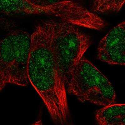 Immunocytochemistry/ Immunofluorescence: TRIM72 Antibody [NBP1-86000]