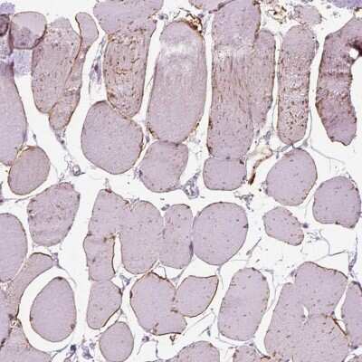 Immunohistochemistry: TRIM72 Antibody [NBP2-49157]