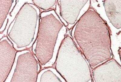 Immunohistochemistry-Paraffin: TRIM72 Antibody [NBP1-52104]
