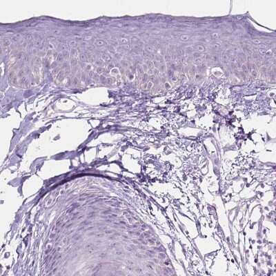 Immunohistochemistry-Paraffin: TRIM72 Antibody [NBP2-49157]