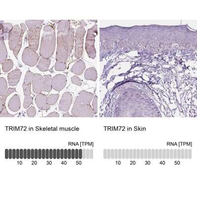 Immunohistochemistry-Paraffin: TRIM72 Antibody [NBP2-49157]