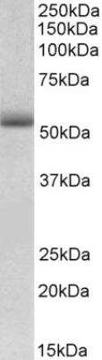 Western Blot: TRIM72 Antibody [NBP1-52104]