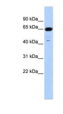 Western Blot: TRIM72 Antibody [NBP1-55029]