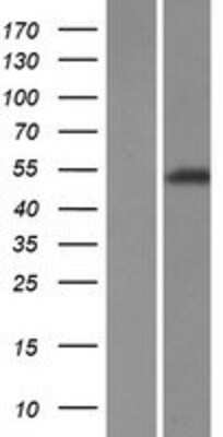 Western Blot: TRIM72 Overexpression Lysate [NBP2-08805]