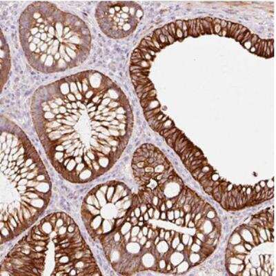 Immunohistochemistry: TRIM73 Antibody [NBP2-30754]