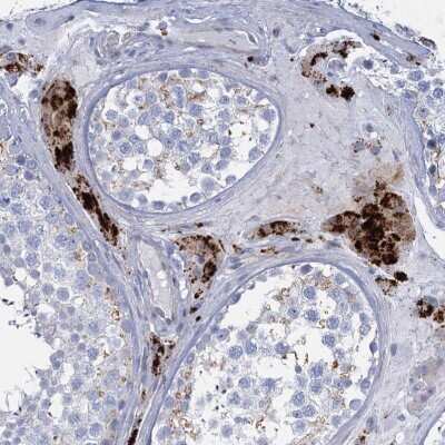 Immunohistochemistry: TRIM77 Antibody [NBP2-32617]