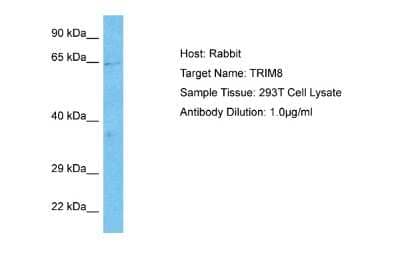 Western Blot: TRIM8 Antibody [NBP3-10335]