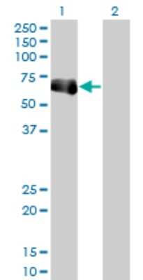 Western Blot: TRIM9 Antibody (1F12) [H00114088-M01]