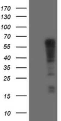 Western Blot: TRIM9 Antibody (OTI2A1) [NBP2-46233]