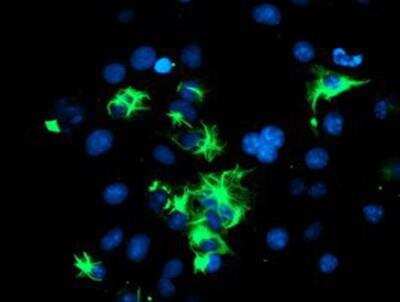 Immunocytochemistry/ Immunofluorescence: TRIM9 Antibody (OTI2D6) [NBP2-03794]