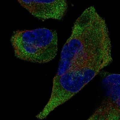 Immunocytochemistry/ Immunofluorescence: TRIM9 Antibody [NBP2-58964]