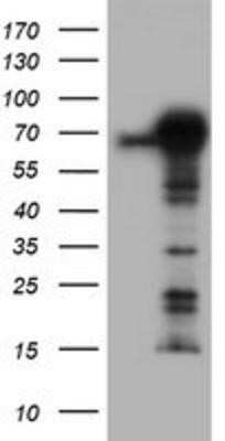 Western Blot: TRIM9 Antibody (OTI2D6)Azide and BSA Free [NBP2-74616]