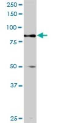 Western Blot: TRIM9 Antibody [H00114088-D01P]