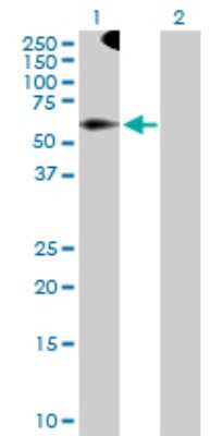Western Blot: TRIM9 Antibody [H00114088-D01P]
