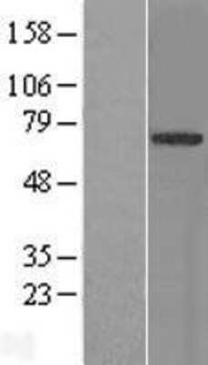 Western Blot: TRIM9 Overexpression Lysate [NBL1-17316]