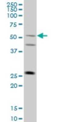 Western Blot: TRIML1 Antibody (4F8) [H00339976-M01]