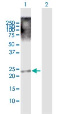 Western Blot: TRIML1 Antibody [H00339976-D01P]