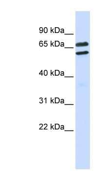 Western Blot: TRIML1 Antibody [NBP1-54340]