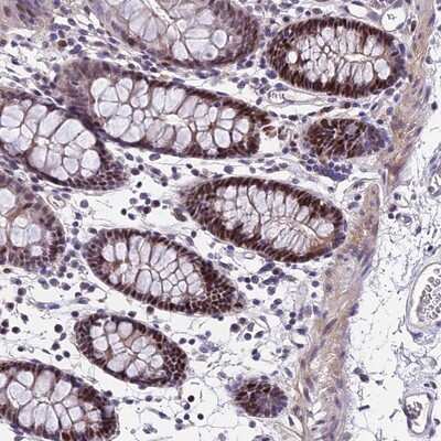 Immunohistochemistry-Paraffin: TRIML2 Antibody [NBP1-92531]
