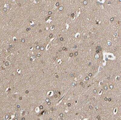 Immunohistochemistry-Paraffin: TRIO Antibody [NBP1-88822]