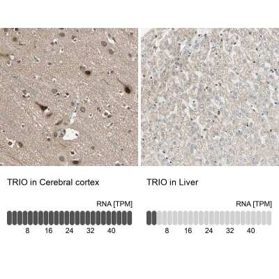 Immunohistochemistry-Paraffin: TRIO Antibody [NBP1-88822]