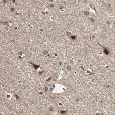 Immunohistochemistry-Paraffin: TRIO Antibody [NBP1-88822]
