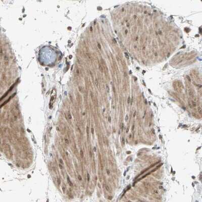 Immunohistochemistry-Paraffin: TRIO Antibody [NBP1-88822]