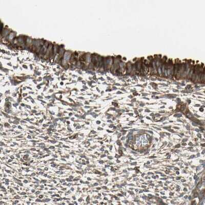 Immunohistochemistry-Paraffin: TRIO Antibody [NBP1-88822]
