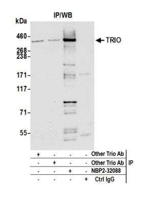 Immunoprecipitation: TRIO Antibody [NBP2-32088]