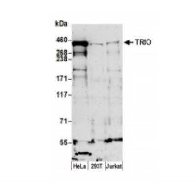 Western Blot: TRIO Antibody [NBP2-32088]