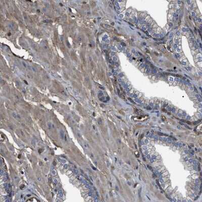 Immunohistochemistry-Paraffin: TRIOBP Antibody [NBP1-90589]