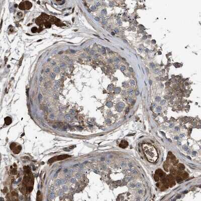Immunohistochemistry-Paraffin: TRIOBP Antibody [NBP1-90589]