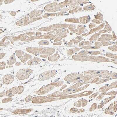 Immunohistochemistry-Paraffin: TRIOBP Antibody [NBP1-90590]