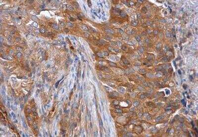 Immunohistochemistry-Paraffin: TRIOBP Antibody [NBP2-20726]